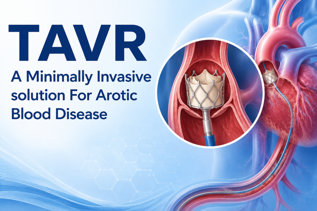 TAVR: A Minimally Invasive solution For Arotic Blood Disease