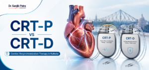 Cardiac resynchronization therapy in Kolkata